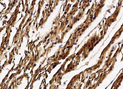 Immunohistochemistry-Paraffin: GSTM2 Antibody (005) [NBP2-90039]