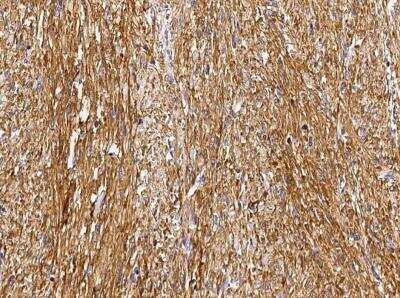 Immunohistochemistry-Paraffin: GSTM2 Antibody (005) [NBP2-90039]