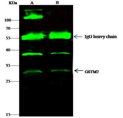 Immunoprecipitation: GSTM2 Antibody (006) [NBP2-90040]