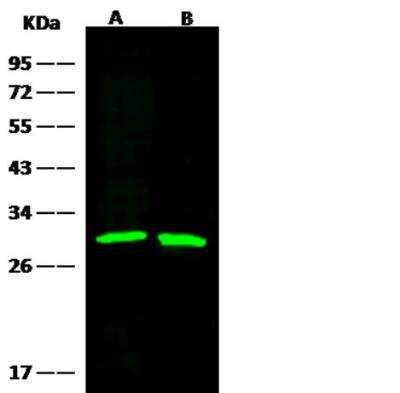 Western Blot: GSTM2 Antibody (006) [NBP2-90040]