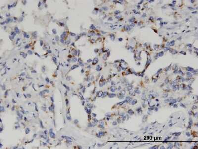 Immunohistochemistry-Paraffin: GSTM2 Antibody (1E10) [H00002946-M03]