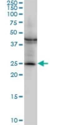 Western Blot: GSTM2 Antibody (1E10) [H00002946-M03]