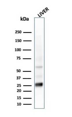 Western Blot: GSTM2 Antibody (CPTC-GSTMu2-2)Azide and BSA Free [NBP3-08255]