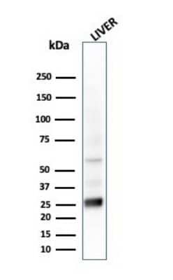 Western Blot: GSTM2 Antibody (CPTC-GSTMu2-2) [NBP3-07346]