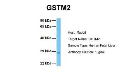 Western Blot: GSTM2 Antibody [NBP1-55103]