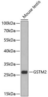 Western Blot: GSTM2 AntibodyBSA Free [NBP3-04532]