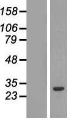 Western Blot: GSTM2 Overexpression Lysate [NBL1-11373]