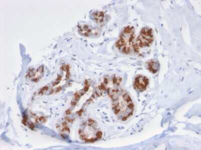 Immunohistochemistry-Paraffin: GSTM3 Antibody (CPTC-GSTMu3-1) [NBP3-07347]