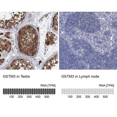 Immunohistochemistry-Paraffin: GSTM3 Antibody [NBP1-83323]