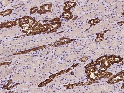 Immunohistochemistry-Paraffin: GSTM3 Antibody [NBP2-97419]