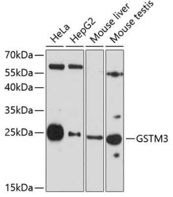 Western Blot: GSTM3 AntibodyAzide and BSA Free [NBP3-04375]