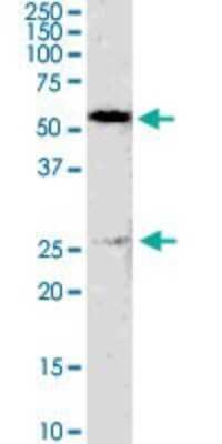 Western Blot: GSTM4 Antibody (4B4) [H00002948-M01]