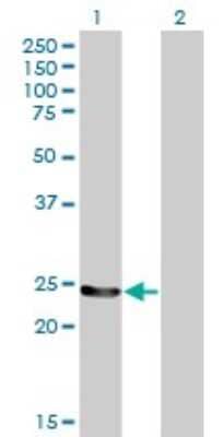 Western Blot: GSTM4 Antibody (4B4) [H00002948-M01]