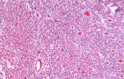 Immunohistochemistry-Paraffin: GSTM4 Antibody [NBP2-75088]