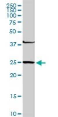 Western Blot: GSTM4 Antibody [H00002948-D01P]