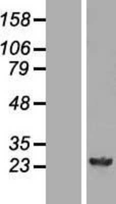 Western Blot: GSTM4 Overexpression Lysate [NBL1-11374]