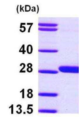 Western Blot: Recombinant Human GSTM4 His Protein [NBP1-45301]