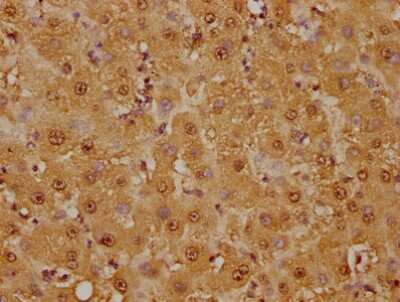 Immunohistochemistry: GSTO1 Antibody (2C7) [NBP3-15189]