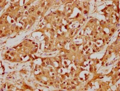 Immunohistochemistry: GSTO1 Antibody (2C7) [NBP3-15189]