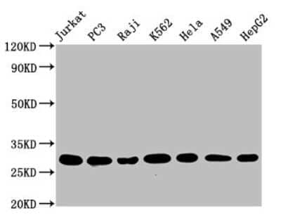 Western Blot: GSTO1 Antibody (2C7) [NBP3-15189]