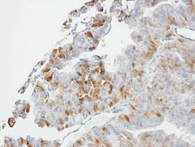 Immunohistochemistry-Paraffin: GSTO1 Antibody [NBP1-33763]