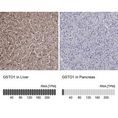 Immunohistochemistry-Paraffin: GSTO1 Antibody [NBP1-83321]