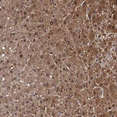 Immunohistochemistry-Paraffin: GSTO1 Antibody [NBP2-32691]