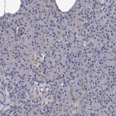 Immunohistochemistry-Paraffin: GSTO1 Antibody [NBP2-32691]