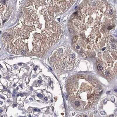 Immunohistochemistry-Paraffin: GSTO1 Antibody [NBP2-32691]
