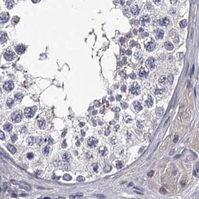 Immunohistochemistry-Paraffin: GSTO1 Antibody [NBP2-32691]