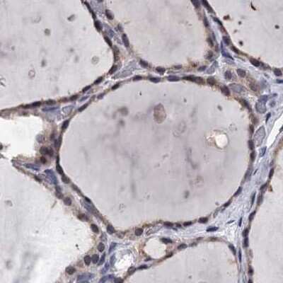 Immunohistochemistry-Paraffin: GSTO1 Antibody [NBP2-32691]