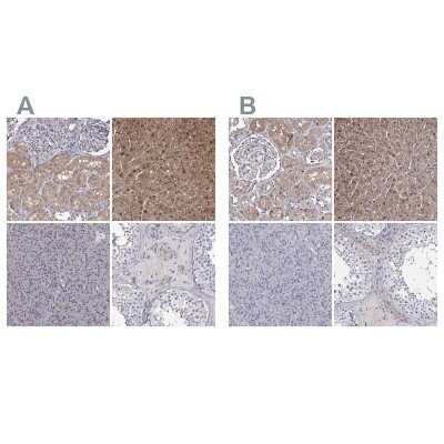 Immunohistochemistry-Paraffin: GSTO1 Antibody [NBP2-32691]