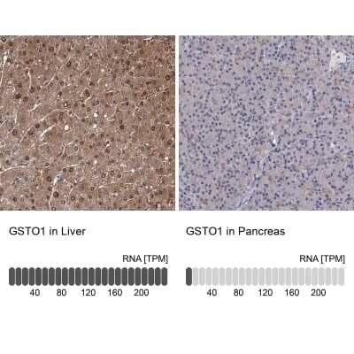 Immunohistochemistry-Paraffin: GSTO1 Antibody [NBP2-32691]