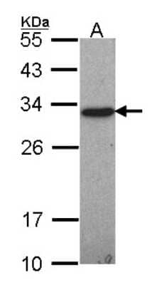 Western Blot: GSTO1 Antibody [NBP1-33763]