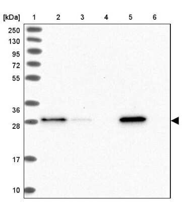 Western Blot: GSTO1 Antibody [NBP2-32691]