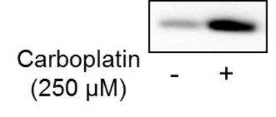 Western Blot: GSTO1 Antibody [NBP2-32691]