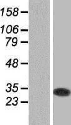 Western Blot: GSTO1 Overexpression Lysate [NBP2-07819]