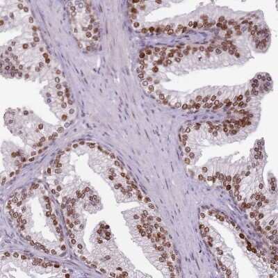 Immunohistochemistry-Paraffin: GSTO2 Antibody [NBP2-14075]