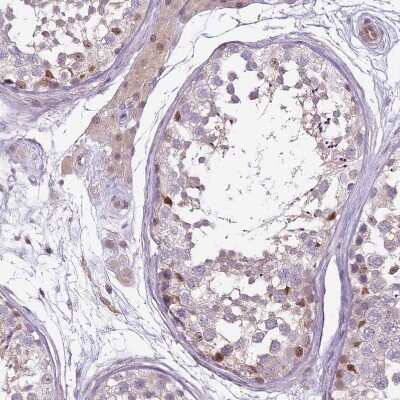 Immunohistochemistry-Paraffin: GSTO2 Antibody [NBP2-14075]