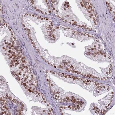 Immunohistochemistry-Paraffin: GSTO2 Antibody [NBP2-14075]