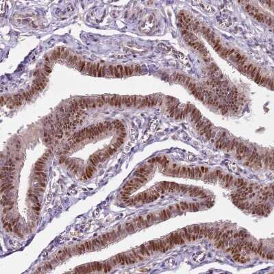 Immunohistochemistry-Paraffin: GSTO2 Antibody [NBP2-14075]