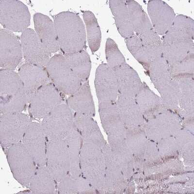 Immunohistochemistry-Paraffin: GSTO2 Antibody [NBP2-14075]
