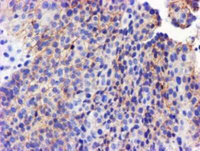Immunohistochemistry: GSTO2 Antibody (OTI2A12) - Azide and BSA Free [NBP2-72371]