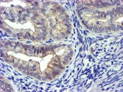 Immunohistochemistry-Paraffin: GSTO2 Antibody (OTI2A12) [NBP2-01626]