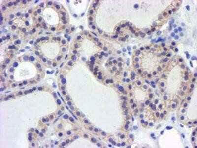 Immunohistochemistry-Paraffin: GSTO2 Antibody (OTI2A12) [NBP2-01626]