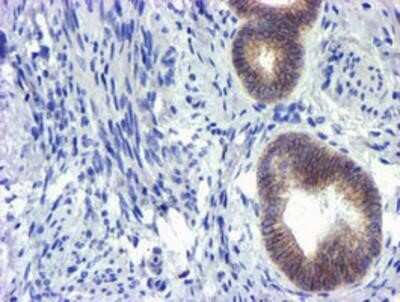 Immunohistochemistry-Paraffin: GSTO2 Antibody (OTI2A12) [NBP2-01626]