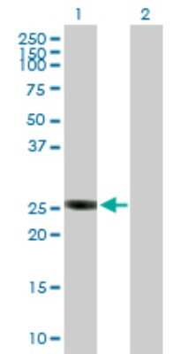 Western Blot: GSTO2 Antibody [H00119391-B01P]