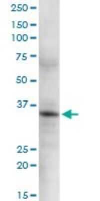 Western Blot: GSTO2 Antibody [H00119391-D01P]