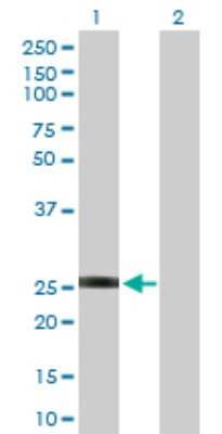 Western Blot: GSTO2 Antibody [H00119391-D01P]