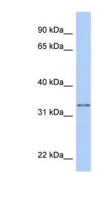 Western Blot: GSTO2 Antibody [NBP1-54580]